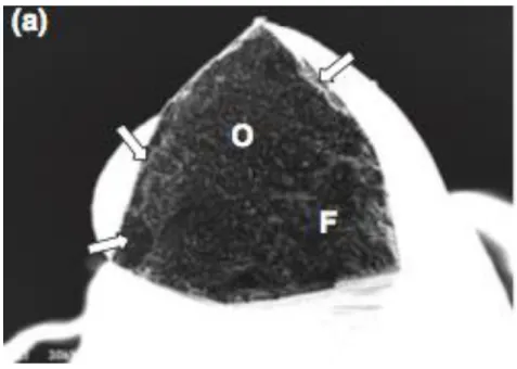 Figure 2: Photographie macroscopique de la section transversale d’un Protaper    