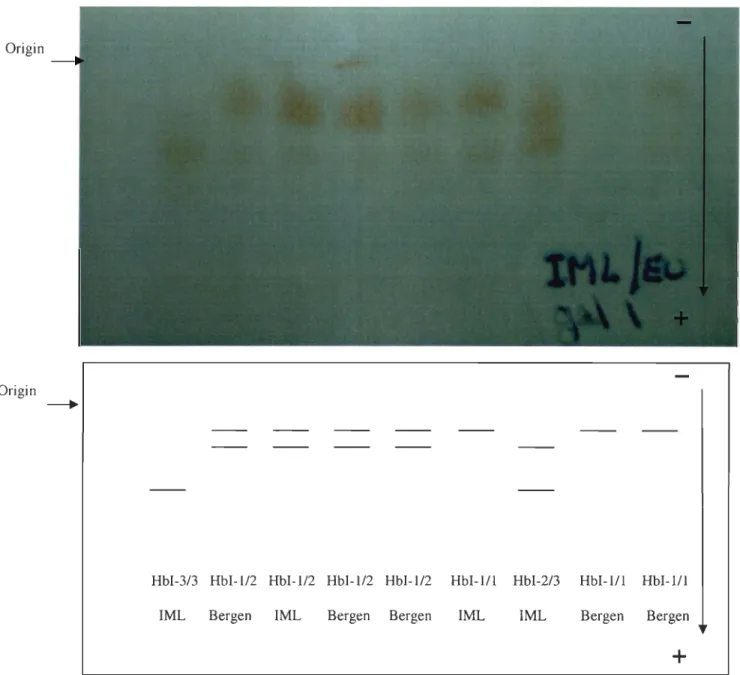 Figure  2.  Picture  and  schematic  representation  of  the  fi ve  electrophoretic  haemoglobin  patterns  observed  on  a  cellulose  acetate  gel