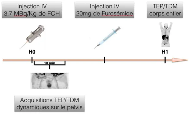 Figure 5. Protocole de TEP/TDM à la 18F-Fluorocholine  