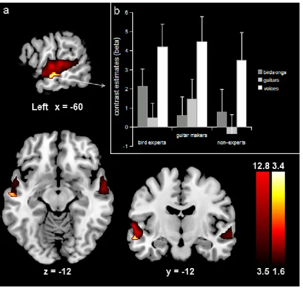 Figure  2:  a)  Group-average  ROIs  (red)  corresponding  to  the  vocal  vs  non-vocal  contrast  from the localizer run (left max.: x,y,z = -60, -15, 0; 490 voxels; t = 12.79; right max.: x,y,z 