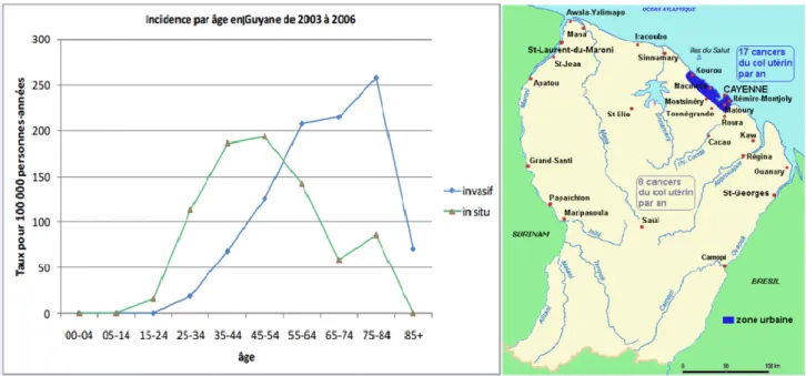 Figure IV : Données générales pour le cancer du col utérin en Guyane entre 2003 et 2006 