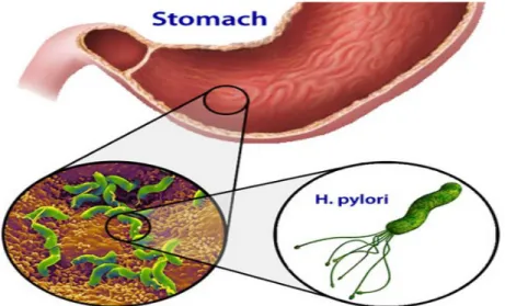 Illustration 7: H. pylori, pathogène de l'estomac humain