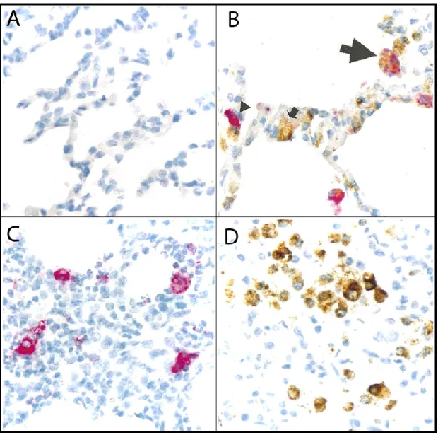 Figure  10.  Co-localisation  des  virus  PCV2  et  VSRRP  au  niveau  du  parenchyme  pulmonaire d’un porc au moyen de sondes d’ARN anti-sens spécifiques marqués à la  fluorescéine  (VSRRP)  et  à  la  digoxygénine  (PCV)