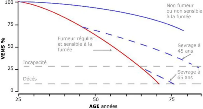 Figure 7 : Déclin du VEMS en fonction de l’âge et du statut tabagique du patient (courbe de Fletcher et al)(49)