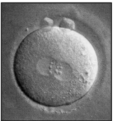 Figure 1 : Zygote (2PN, 2GP) à H18 