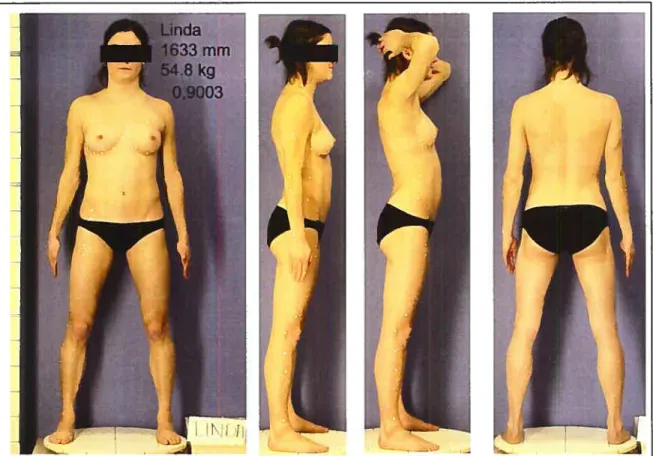 Figure 2.2 Montage du sujet Linda