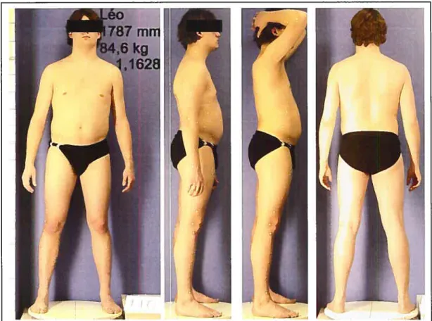 Figure 2.3 Montage du sujet Léo