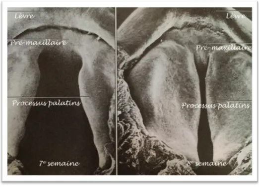 Figure 3: Formation du palais chez un embryon humain. Adapté de Nanci 2008. 6