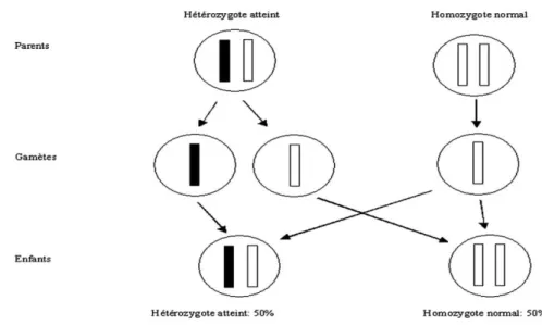 Figure 2 - Transmission d’une maladie autosomique dominante [17] 