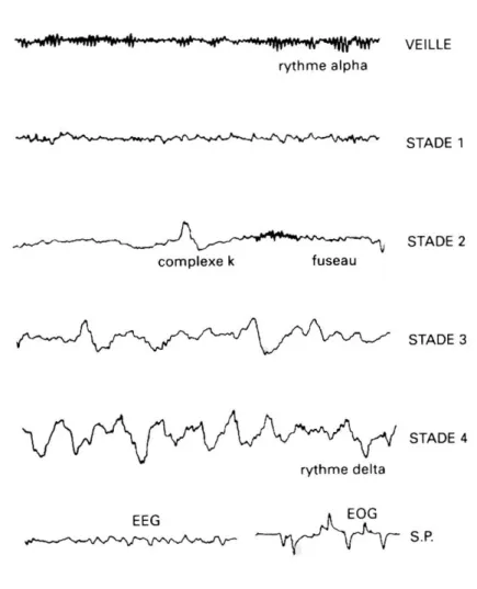 Illustration 9 : Tracés éléctroencéphalographiques caractéristiques des différents stades de  sommeil 
