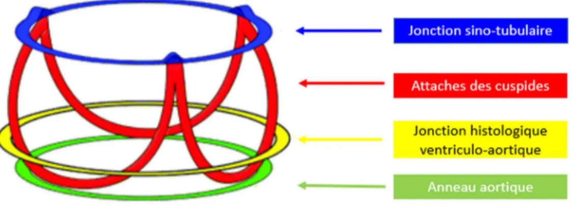 Figure 7 - Modèle tridimensionnel de la racine aortique en « couronne trifoliée », d’après Piazza  et al