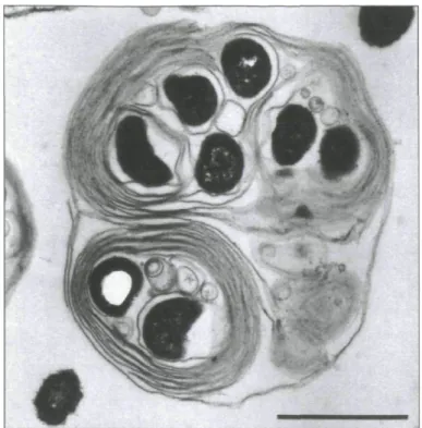 Figure 2. Image en microscope électronique à transmission montrant une vésicule  expulsée de A