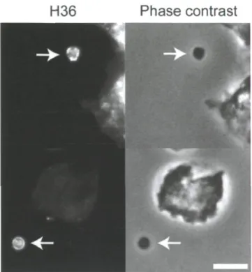 Figure 9. La production des CMLs H36-positifs par l'amibe en présence de  bactéries Klebsiella digestibles