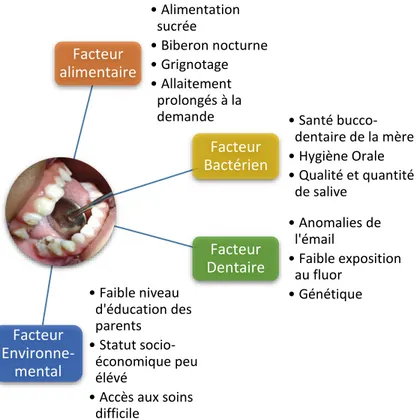 Figure 5 : Anatomie de la dent temporaire 