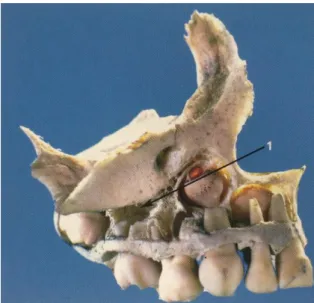 Figure 2 : Vue de profil d’un maxillaire d’un enfant de 24 mois. L’évolution dentaire a libéré la place  dans le secteur prémolaire (1)