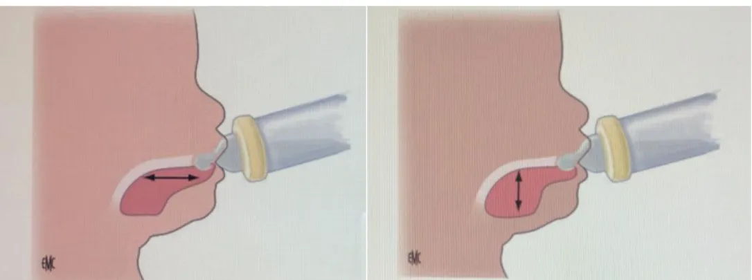 Figure 1 : Suckling versus sucking 