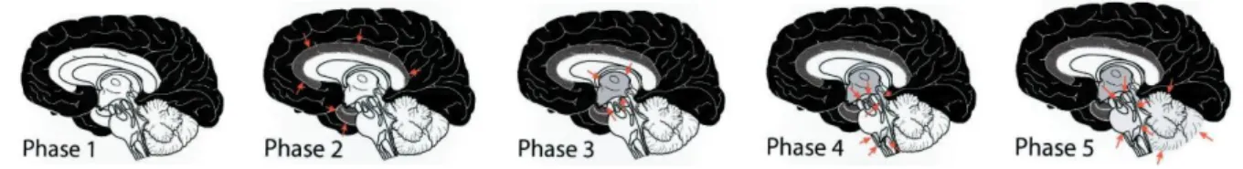 Figure 1 : Progression des dépôts amyloïdes cérébraux, selon les Phases de Thal, (25) 