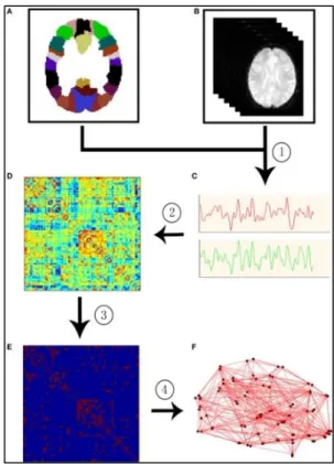 Figure 9 : Séquences de réalisation d’un réseau cérébral humain de connectivité fonctionnelle  par la théorie des graphes
