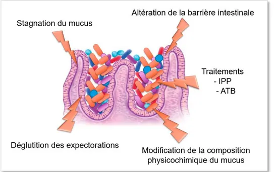 Figure 7 : Résumé des mécanismes possibles expliquant la dysbiose intestinale chez  les patients atteints de mucoviscidose   