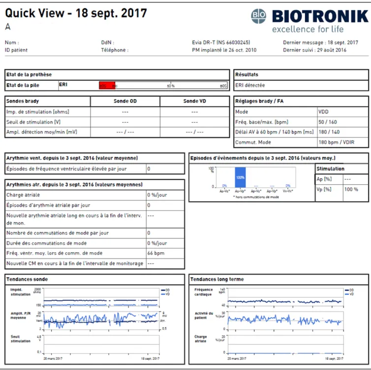 Figure 1 Alerte d’ERI d’un stimulateur Evia DR-T Biotronik 