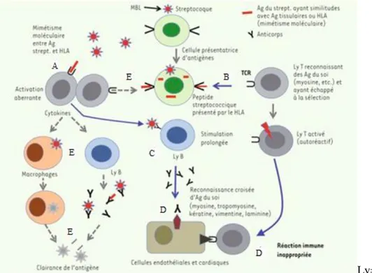 Figure 8. Schématisation de la réponse immunitaire inappropriée                     Ag=Antigène  MBL=  Mannose Binding Lectin