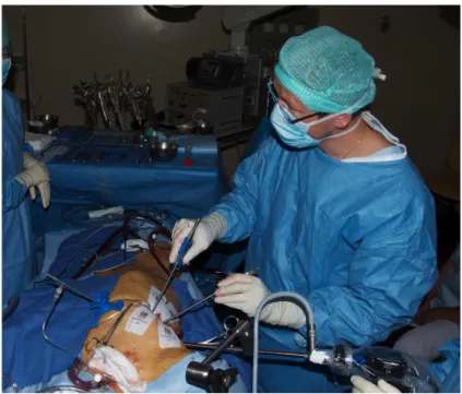 Figure 12: Chirurgie mitrale vidéo assistée par mini thoracotomie antéro latérale droite.
