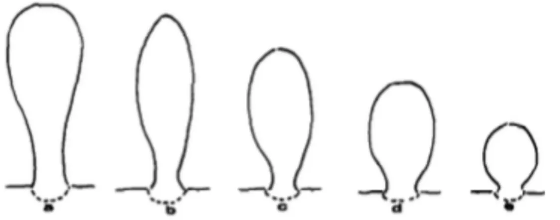 Figure 5  : Schéma résumant les différences morphologiques des odontoblastes au  niveau de corne (Marion et al