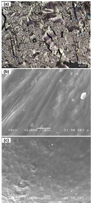 Figure 4 Optical microscope micrograph showing (a) general view  (A: anisotropic structure, I: isotropic sturcture); and SEM images 