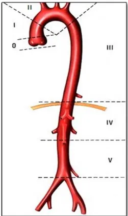 Figure 1 : Schématisation  segmentaire Aortique 