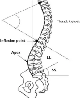 Figure 4: équilibre sagittal 