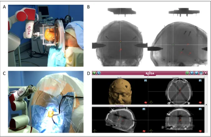 Figure 2 : Surgical work flow with intraoperative imaging control 