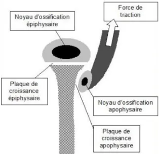 Figure 3 : Schéma des différentes forces exercées sur le cartilage de croissance  (D’après Docteur Louis Pallure) (22) 