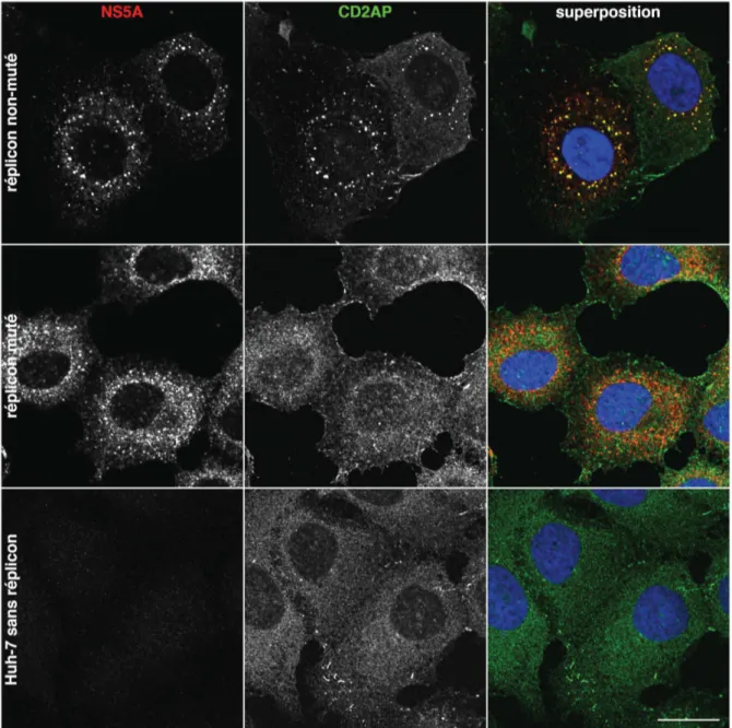 Figure  7.  Effet  de  la  mutation  de  NS5A  sur  la  répartition  intracellulaire  de  CD2AP