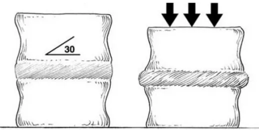 Figure 4: Orientation des fibres de l’annulus fibrosus par rapport aux plateaux vertébraux [10] 