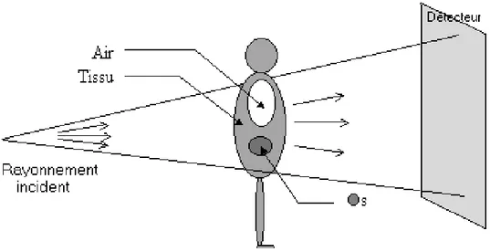 Figure  10:  Système  radiographique  avec  un  émetteur  de  rayon  X  (le  tube  radiogène)  et  un  détecteur