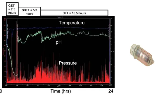 figure 10. A gauche : courbes de pH, température et pression gastriques, duodénales et coliques