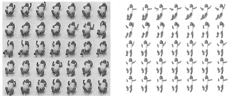 Figure 5 : Mouvements généraux chez deux nourrissons de 3 mois (sain à gauche, parétique à droite) 