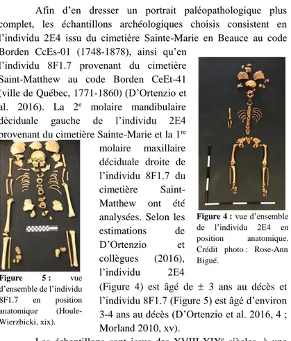 Figure 4 : vue d’ensemble  de  l’individu  2E4  en  position  anatomique. 