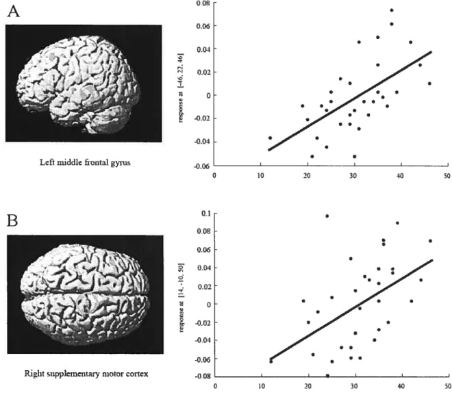 Figure 1 Correlations between poor social cognitive performance and reduced grey matter density in the lefi middle frontal gyms (Panel A) and the supplementary motor cortex (Panel B) in first episode psychosis.