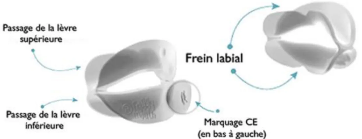 Figure 10 : FroggyMouth® 