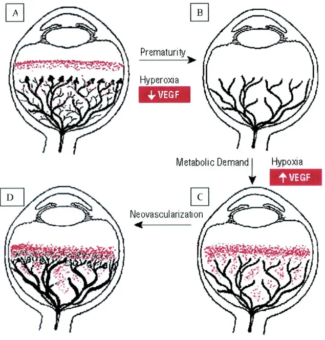 Figure  2 :  Rôle  supposé  du  VEGF.  A :  Le  développement  normal  des  vaisseaux  rétiniens  serait stimulé par la production de VEGF (indiqué en rouge) présent avant le développement  du  système  vasculaire
