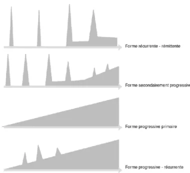 Figure 2 : Classification internationale des modes évolutifs de la SEP de Lublin  FD. et Reingold SC