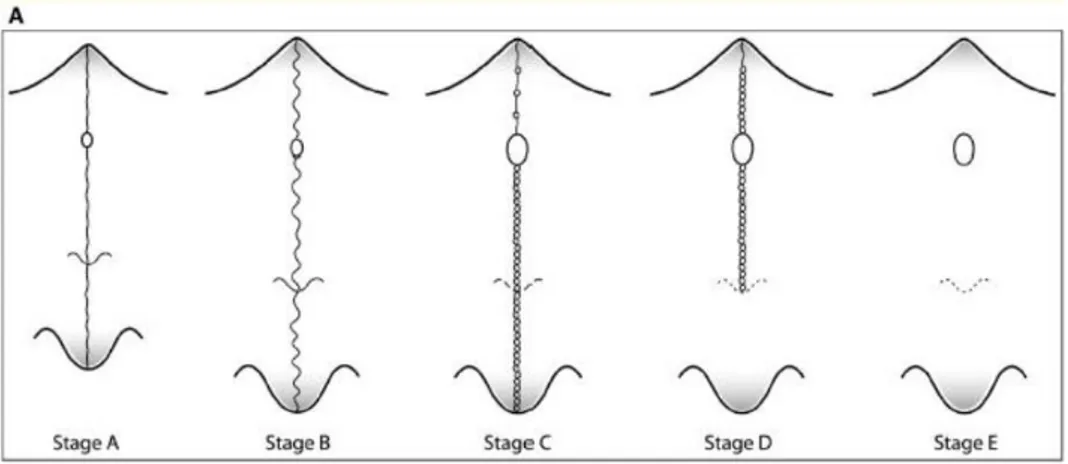Figure 5 : Schéma montrant les différents stades de maturation de la suture palatine intermaxillaire  