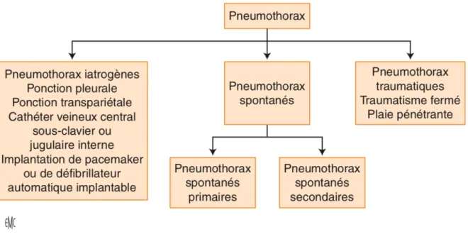 Figure 3. Classification des pneumothorax.  Source D. Contou, B. Maitre. Pneumothorax spontanés