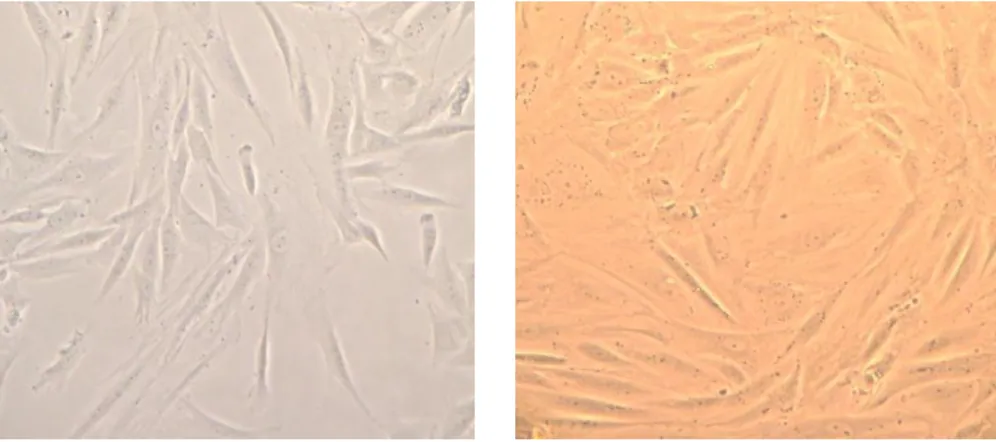 Figure  2  –  Monocyte-derived  macrophages.  Pictures  were  taken  in  culture  wells  at  H48  after  infection