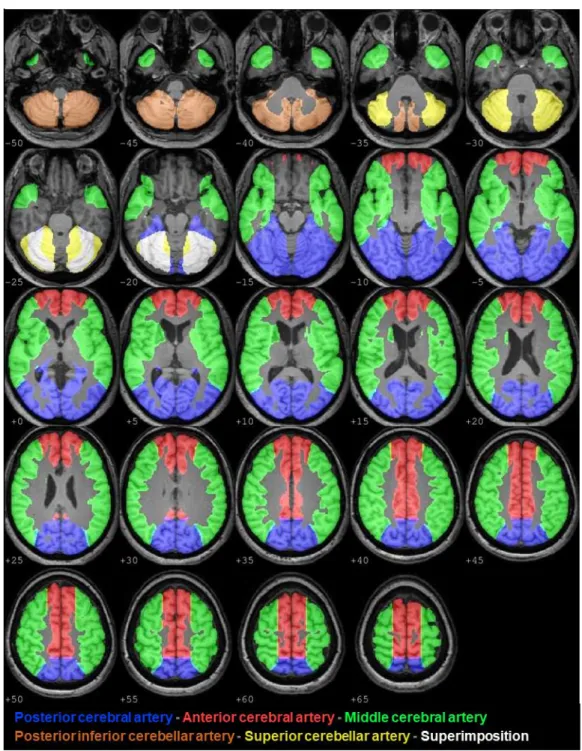 Figure 2: Individual regions of interest in major cerebral arteries territories. 