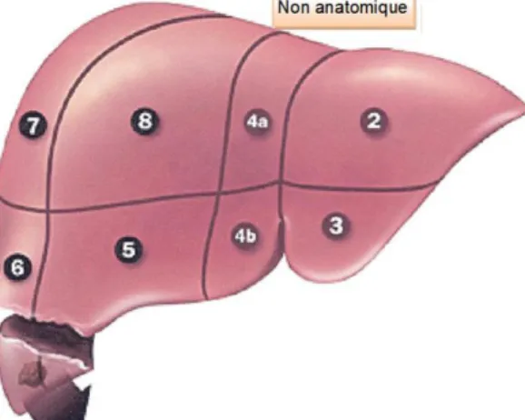 Figure 7: Résection hépatique non anatomique  Source : www.colorectal-cancer.ca 