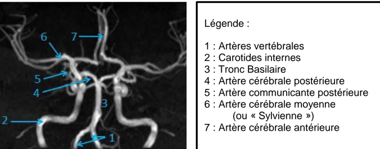 Figure 1: Anatomie du Polygone de Willis en IRM séquence TOF