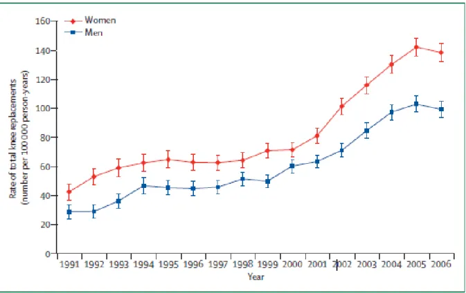 Figure 15 : évolution du nombre de PTG en Grande Bretagne entre 1991 et 2006, chez les  hommes (en bleu) et les femmes (en rouge)