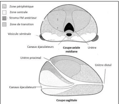 Fig. 3 : Segmentation des différentes zones de la prostate (coupe axiale et sagittale) [Source : http://www.urologywaikato.co.nz/prostate/cancer, consultée 01/06/2018] 